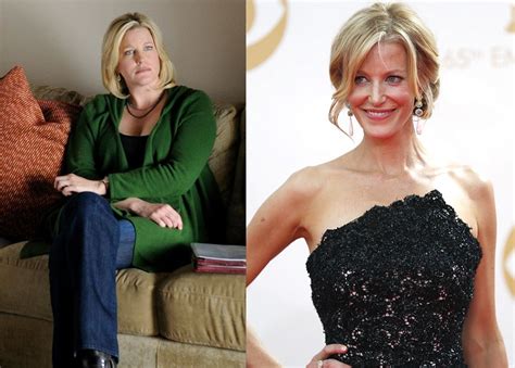 Anna Gunn Weight Loss: Actress Says Weight Gain。